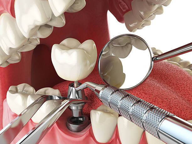Best Emergency Dentist for Knocked-Out Tooth in Remsenburg Speonk, NY